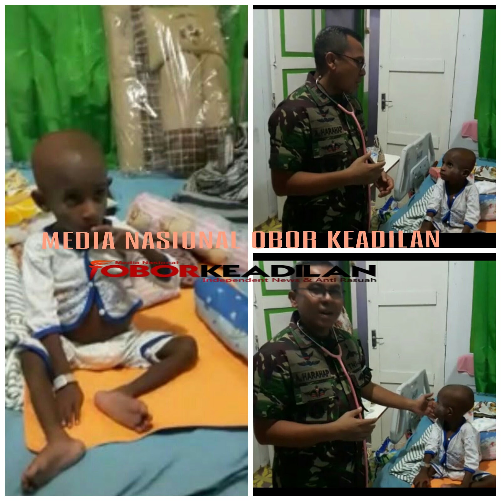 Satgas Kesehatan TNI Asmat Berhasil Pulihkan Anak Penderita Gizi Buruk 