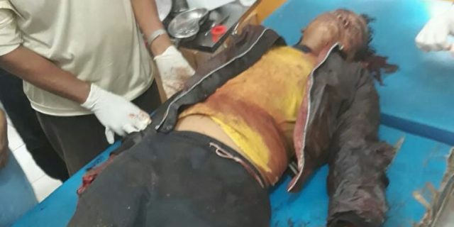 Duel Maut  Warga Negara Ratu Di Register 46 ,1 Orang Tewas.