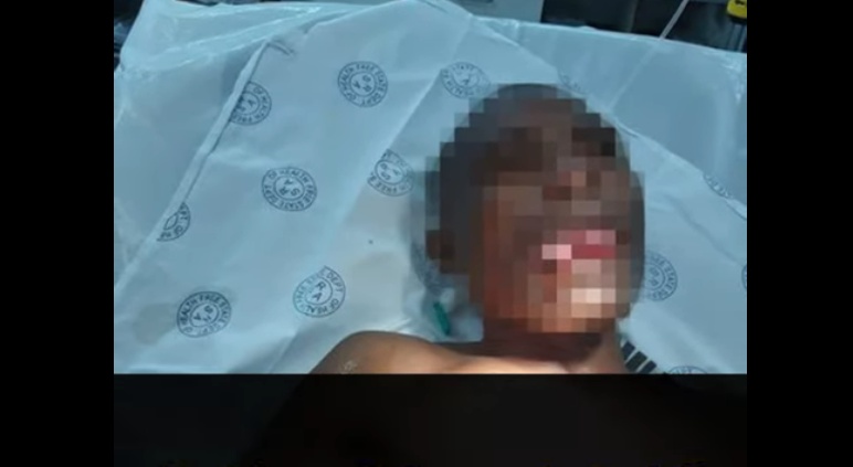 Korban Seks Pemerkosa Dokter Muda Gigit Lidah Pelaku Sampai Putus