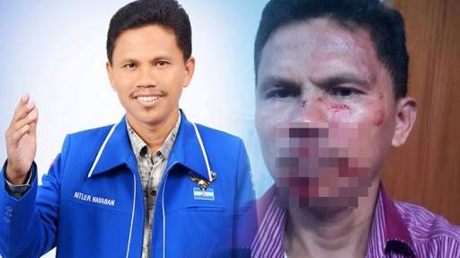 Pemukulan Hitler Nababan Anggota DPRD Karawang ,  Damai Hari Lubis : Kami mengingatkan  Polri tegas  Memproses   kasus  Jeratan  UU IT 