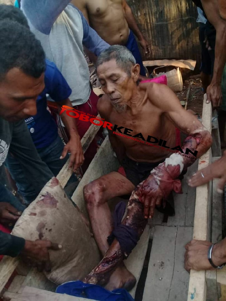 Tercabik Cabik Digigit Komodo Kaki Dan Tangan Thai Warga Pulau Rinca babak Belur