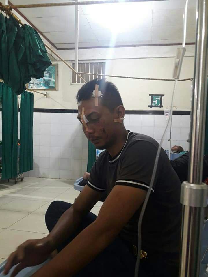 Gara-Gara Nonton Bareng Piala Dunia, Anggota Brimob Jadi Korban Penganiayaan Oknum Polisi