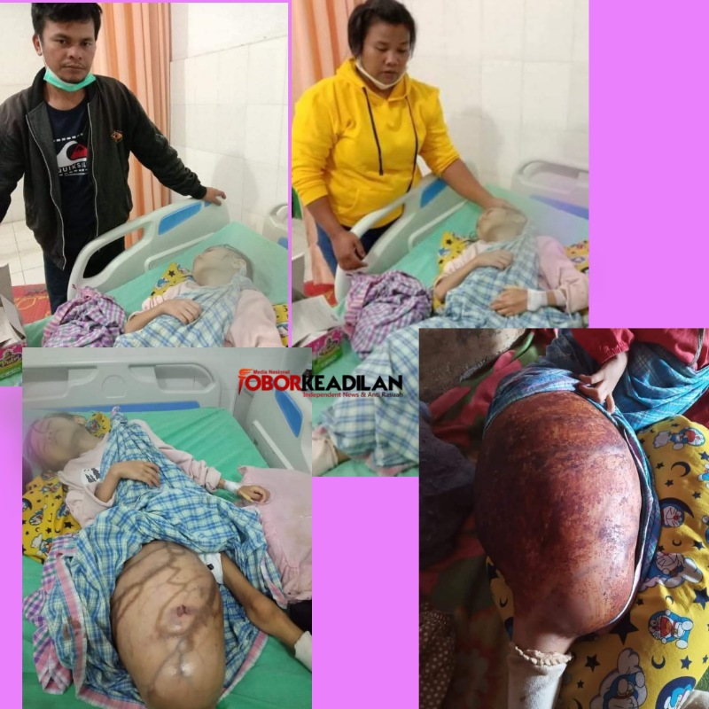 Erliza Boru Hutapea (8 Th) Diduga Penderita Kanker Terbaring 8 Bulan Berobat Kampung, Mohon Donasi Amal