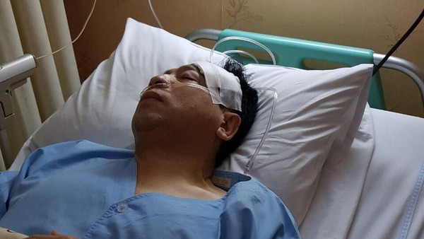 Penampakan Setnov pasca Kecelakaan , Nubruk Tiang Listrik dan Fortuner Jadi 'Korban'