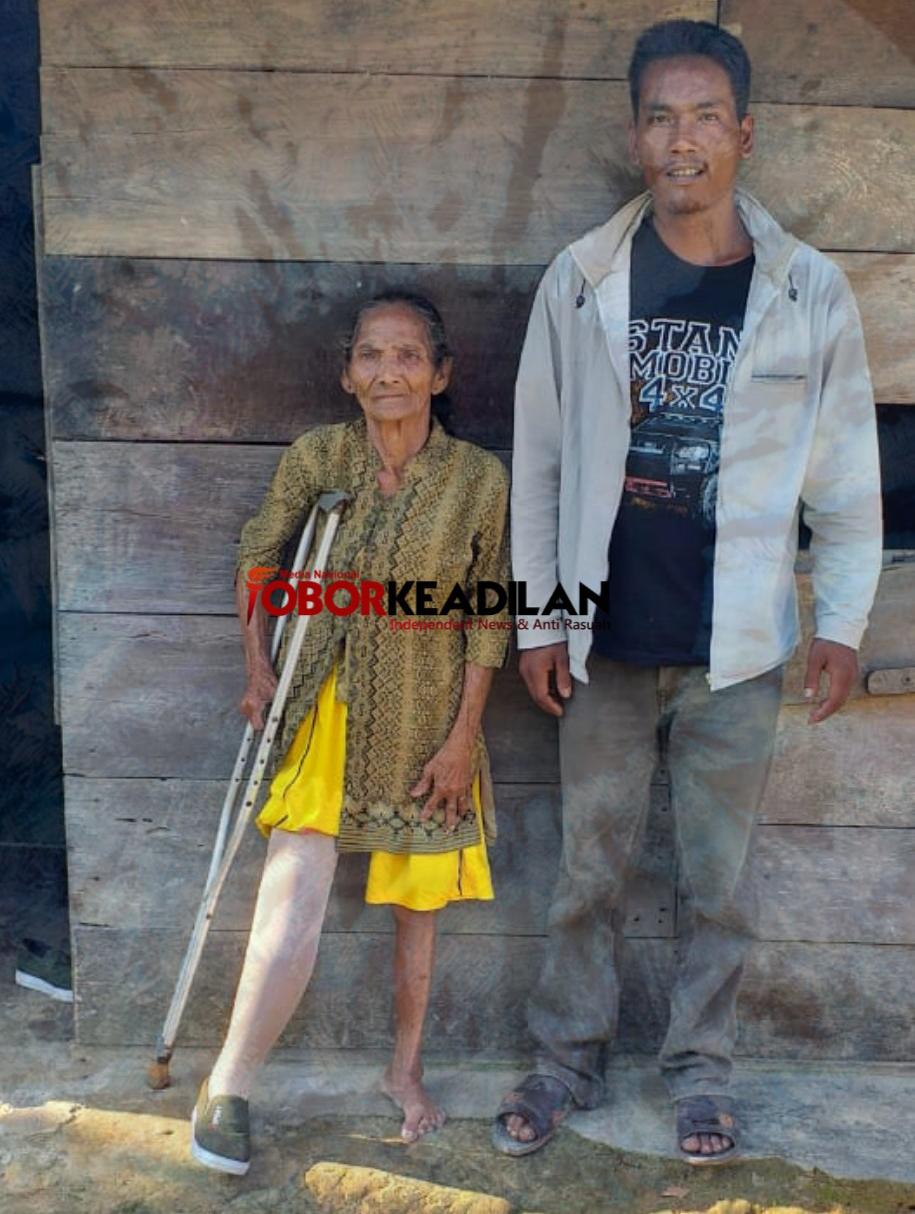 Viral di Media Obor Keadilan, Baritana Siagian Terima Kaki Palsu Langsung Dari Bupati Tobasa