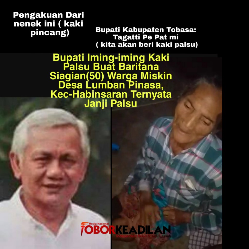 Kaki Palsu Buat Baritana Siagian (50) Warga Desa Lumban Pinasa, Kec-Habinsaran Ternyata Janji Palsu Bupati Tobasa