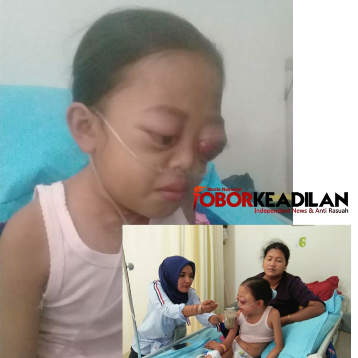 Terjangkit Kanker Sum-sum Tulang, Kondisi Subaedah (10) Kian Parah, Dinsos Rohil Cuma Kasih Surat 