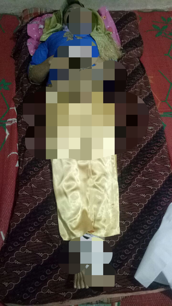 Atas Meninggalnya Boru Aritonang Diduga Kuat Dokter ICU RSE Lalai Dan Salah Penanganan