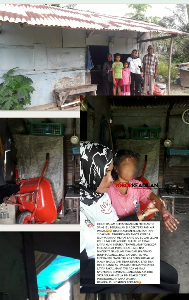 Keliling Dagang Kue, Anak 1 Gila Dan 1 lagi Luka Bakar, Lengkaplah Derita Ibu Yaris Warga Duri Riau