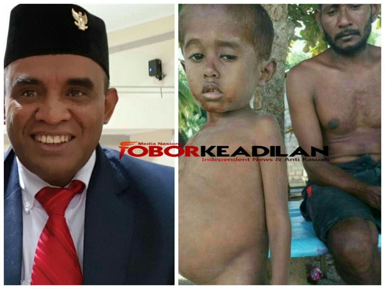 Majelis Rakyat Papua (MRP) Papua Barat Soroti Gizi Buruk Di Kabupaten Raja Ampat