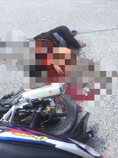 Sadis Kaki Remuk , korban lakalantas di Pos 2 PT RAPP makan korban 