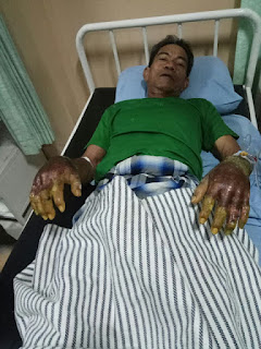 Menunjukan Kesaktian, Malah Berujung Ke Rumah Sakit.