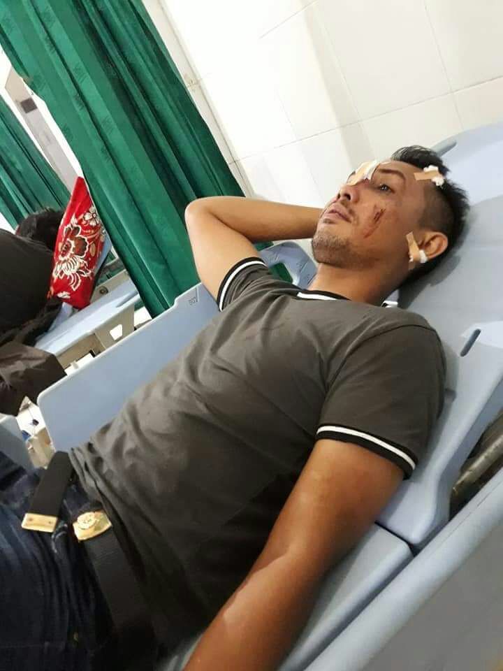 "Gol apa goblok" ? Pungkas oknum Polres Sorong hingga  Berujung Penganiayaan korban adalah Anggota Brimob