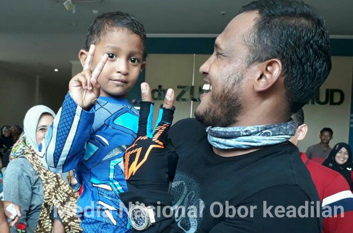 RS Zubir Mahmud Berhasil Operasi 47  Penderita Bibir Sumbing di Aceh Timur