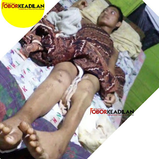 Pihak Keluarga Akbar, Korban  Kecelakaan kerja Minta Keadilan Atas Kecelakaan Anaknya 
