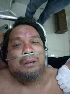 Satu Polisi Tewas mengenaskan di POLDASU di Duga di Bantai Teroris
