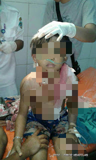 Bocah perempuan, ID (11)  dan WF (10) ditemukan berlumuran darah di bebatuan Sungai Ciloseh, Kecamatan Purbaratu, Kota Tasikmalaya Jawa Barat