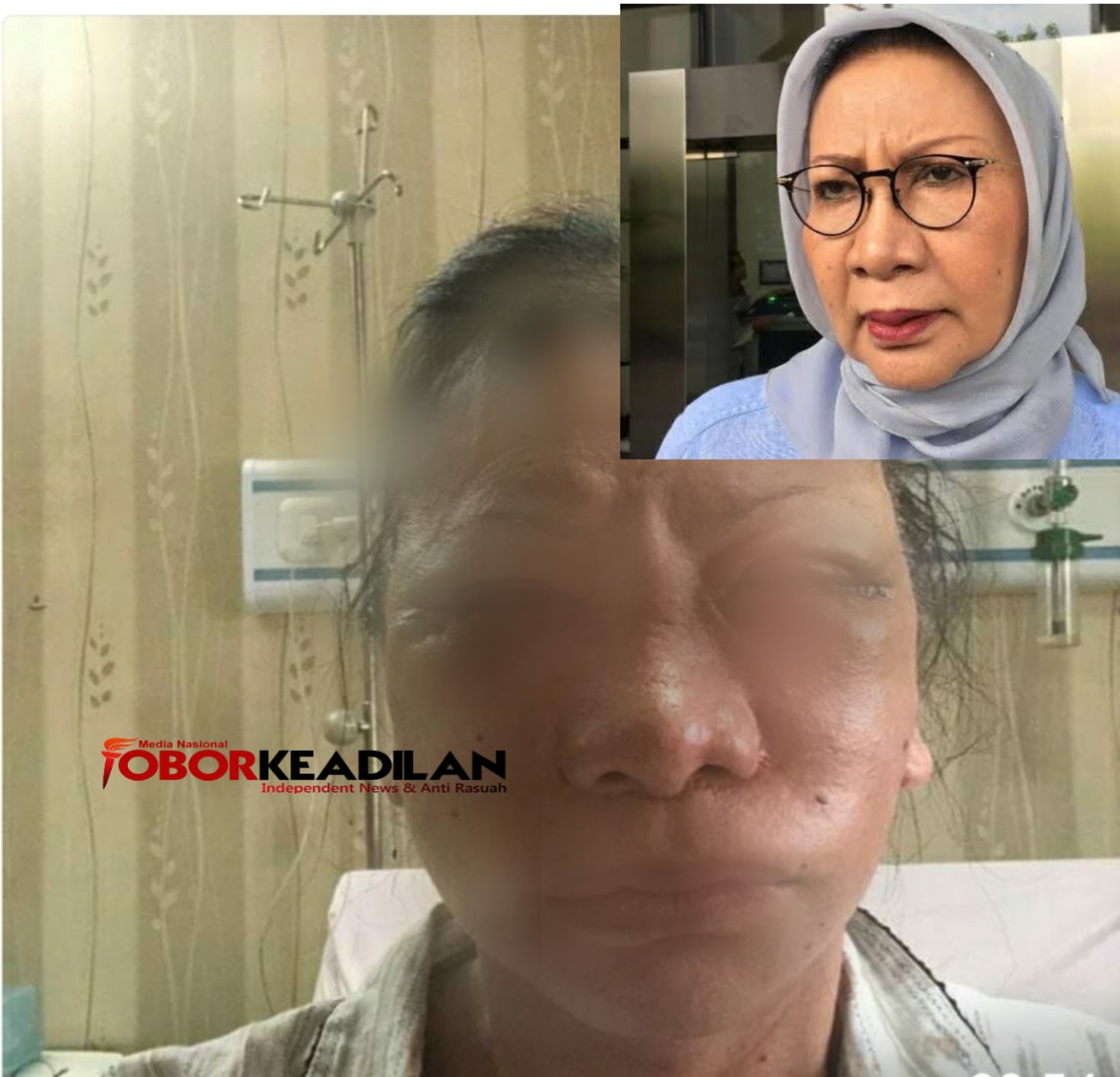 Ratna Sarumpaet Dikabarkan Benjol Lebam-lebam Pelipis Mata Dianiaya Orang Tak Dikenal