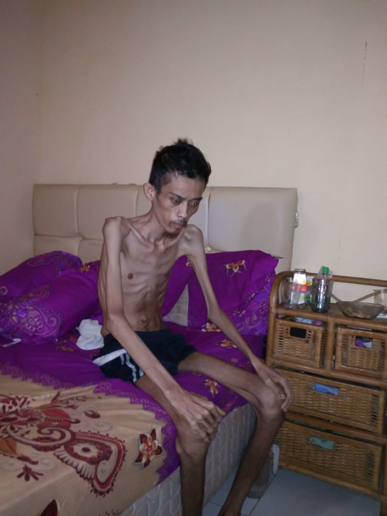 Sedih !!! Sang Ibu (Deri-red) Kecewa Dengan Pemda, Harap Ada Darmawan Yang Peduli Nasib Sang Buah Hati