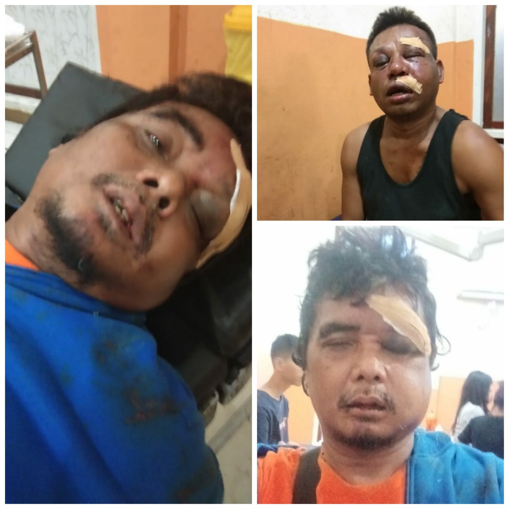 Anggota Denzipur Nabire Hajar Dua Wartawan Hingga Babak Belur