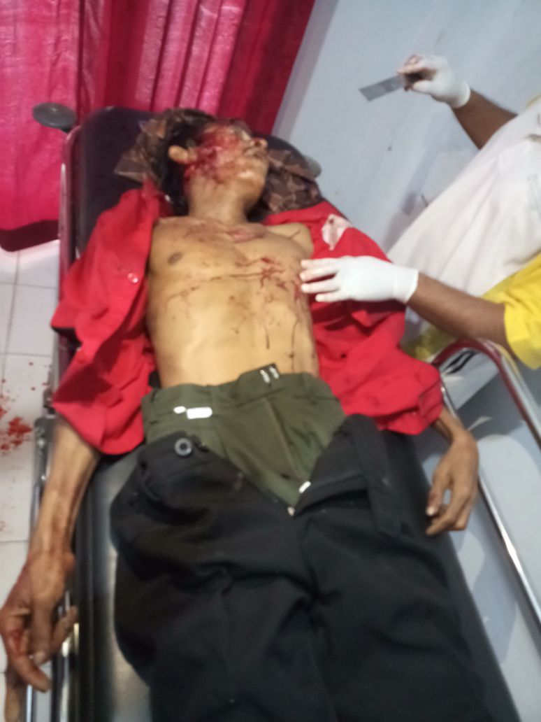 Daud Korban Penganiayaan Orang Tak Dikenal Menyebabkan korban Meninggal Dunia 