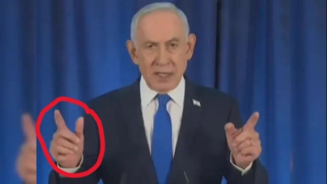 Anomali Fisik PM Netanyahu Memicu Spekulasi di Media Sosial Global