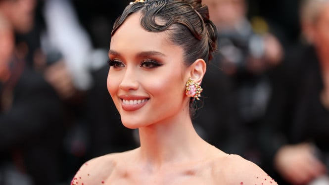 Artis Cinta Laura Jalani Operasi Darurat Usai Kecelakaan di Dapur, Fans Bereaksi Khawatir