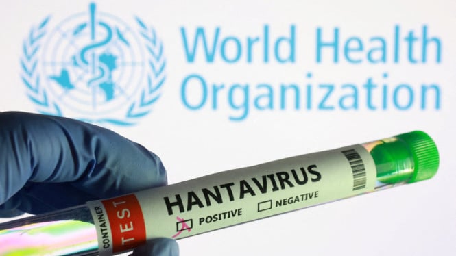 Hasil Tes Laboratorium Kemenkes Memastikan Warga Kulon Progo Terbebas dari Virus Hanta