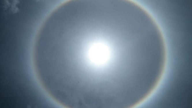 Paparan Radiasi Sinar Ultraviolet Matahari Berpotensi Memicu Pterygium, Oftalmolog Ingatkan Pentingnya Proteksi Mata Sejak Dini
