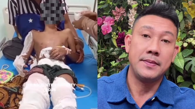 Kasus Santri Terbakar di Lombok Tengah Raih Perhatian Publik, Denny Sumargo Serukan Pengawalan Hukum yang Transparan