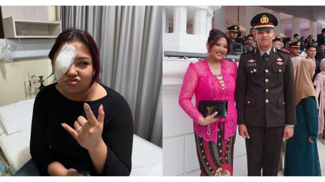 Cedera Mata Tidak Menghalangi Trisha Eungelica Mendampingi Tribrata Putra dalam Pelantikan Perwira Polri
