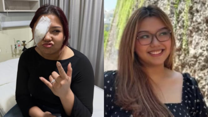 Pemulihan Trisha Eungelica Berlangsung Positif, Anak Ferdy Sambo Kembali Beraktivitas Normal