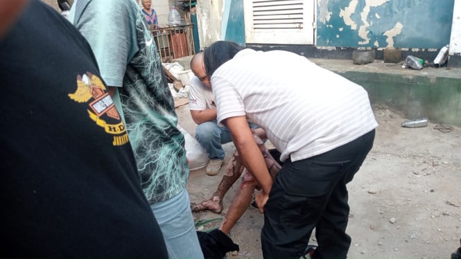 Akibat Fatal Pencurian Kabel: Pria di Tanjung Priok Terbakar Parah Setelah Tersengat Listrik Tegangan Tinggi